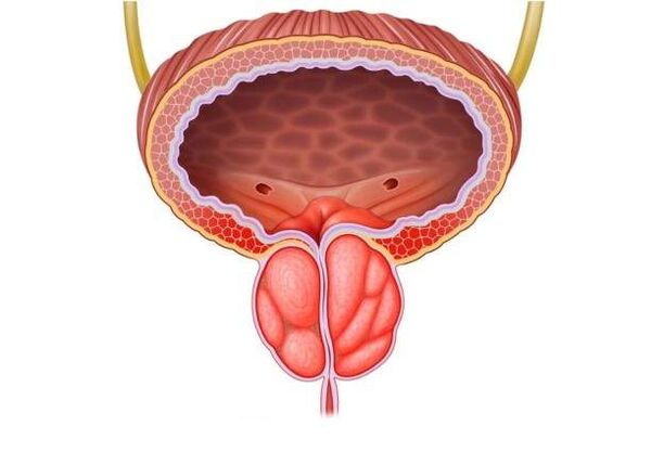 traitement de la prostatite chez les hommes